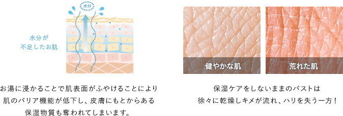 水分が不足したお肌　お湯に浸かることで肌表面がふやけることにより肌のバリア機能が低下し、皮膚にもとからある保湿物質も奪われてしまいます。写真左：健やかな肌　写真右：荒れた肌　保湿ケアをしないままのバストは徐々に乾燥しキメが流れ、ハリを失う一方！