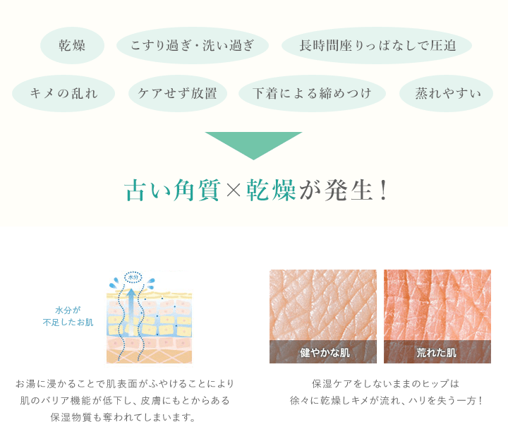 乾燥 こすり過ぎ・洗い過ぎ キメの乱れ 長時間座りっぱなしで圧迫 ケアせず放置 下着による締めつけ 蒸れやすい 古い角質×乾燥が発生！お湯に浸かることで肌表面がふやけることにより肌のバリア機能が低下し、皮膚にもとからある保湿物質も奪われてしまいます。保湿ケアをしないままのヒップは徐々に乾燥しキメが流れ、ハリを失う一方！