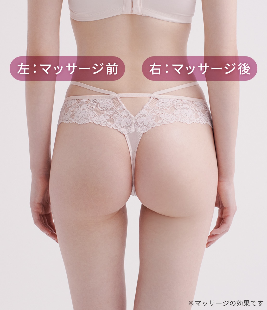 ヒップルン薬用ホワイトクリーム＜医薬部外品＞(- セダクティブ