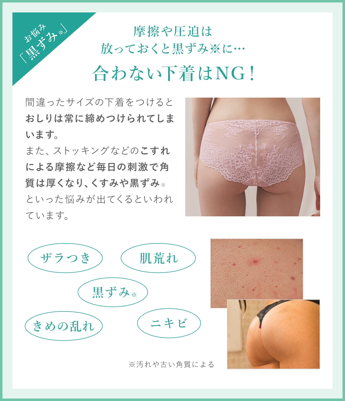 お得にお届け便】ヒップルン薬用スクラブ＜医薬部外品＞(1 セダ